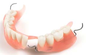 Prótesis dental parcial de abajo en acrílica dentadura parcial