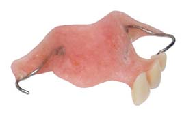 Prótesis dental parcial de arriba en acrílica dentadura parcial