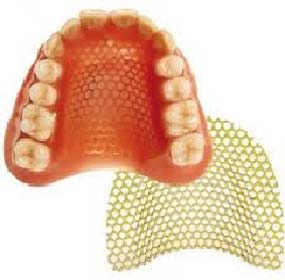 Prótesis dental completa arriba con refuerzo metálico dentadura